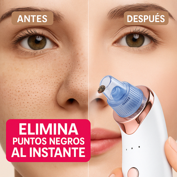 ✨ Bella Cleaner – Succionador de Poros 5 en 1